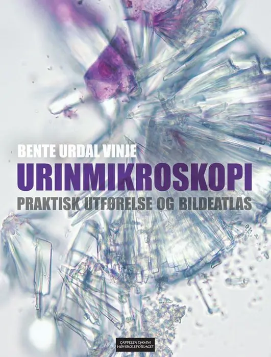 Urinmikroskopi