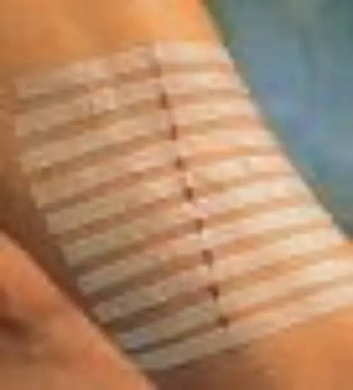 Suturtape 6mm x7,5 cm